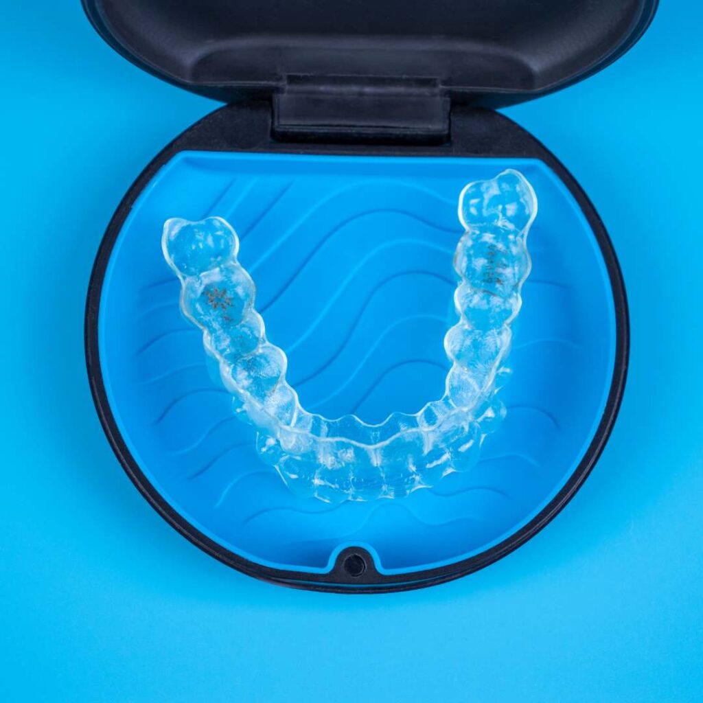 choose clear aligners