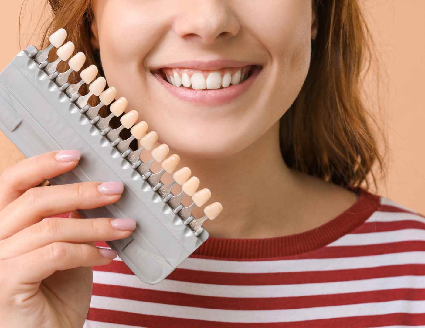 Are Veneers Permanent or Removable?